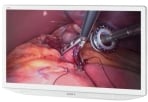 Sony LMD-X550MD medical grade monitor installed in operating room